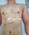 경과사진