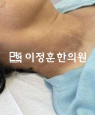 경과사진