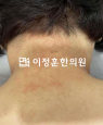 경과사진
