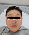 경과사진