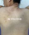 경과사진