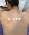 경과사진
