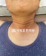 경과사진