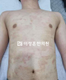 경과사진