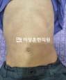 경과사진