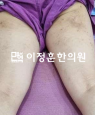 경과사진