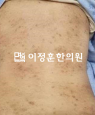 경과사진