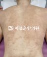 경과사진