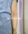 경과사진