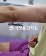 경과사진