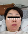 경과사진