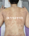 경과사진