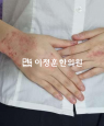 경과사진