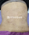 경과사진