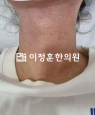경과사진