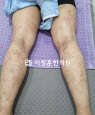 경과사진