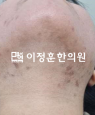 경과사진