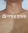 경과사진