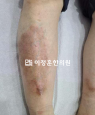 경과사진
