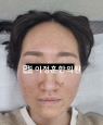 경과사진