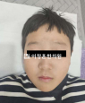 경과사진