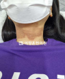 경과사진