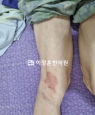 경과사진