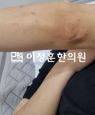 경과사진