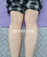 경과사진