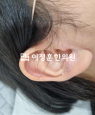 경과사진