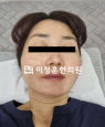 경과사진
