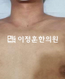 경과사진
