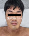 경과사진