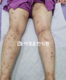 경과사진
