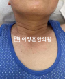 경과사진