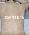 경과사진