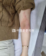 경과사진