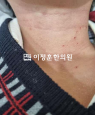 경과사진