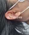 경과사진