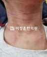 경과사진