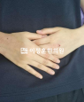 경과사진