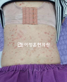 경과사진