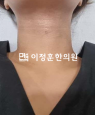 경과사진