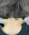 경과사진