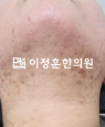 경과사진