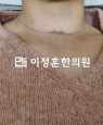 경과사진
