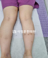 경과사진