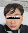 경과사진