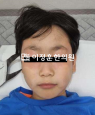 경과사진